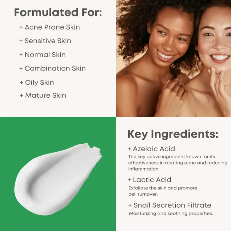 A-Control Azelaic Acid Cream - Image 4