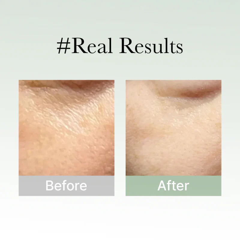 Holy Hyssop Serum 30 - Image 7