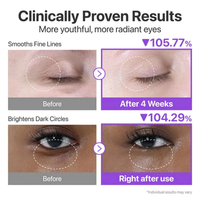 No.9 NAD+ Retinol Volumetox Eye Cream - Image 5