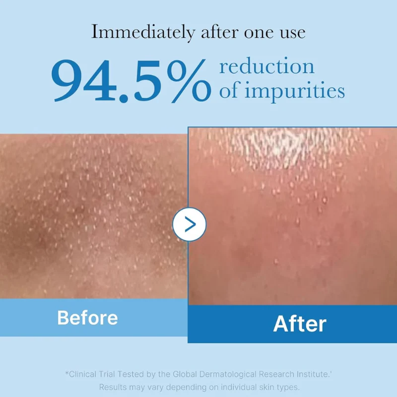 Zero Pore Blackhead Deep Cleansing Oil - Image 5